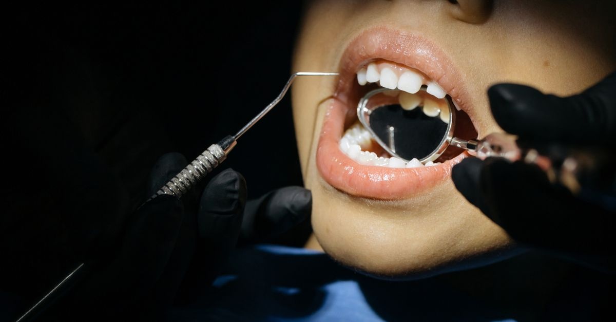 Sorrisi senza carie: come prevenire i problemi ai denti nei bambini fin dai primi anni