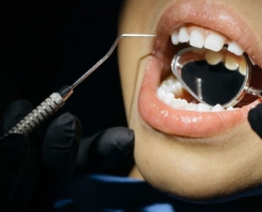 Sorrisi senza carie: come prevenire i problemi ai denti nei bambini fin dai primi anni