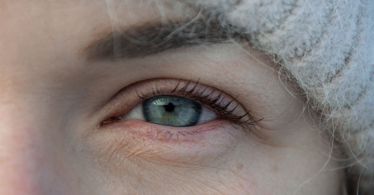 Addio pelle disidratata d’inverno: routine e rimedi efficaci per un viso morbido